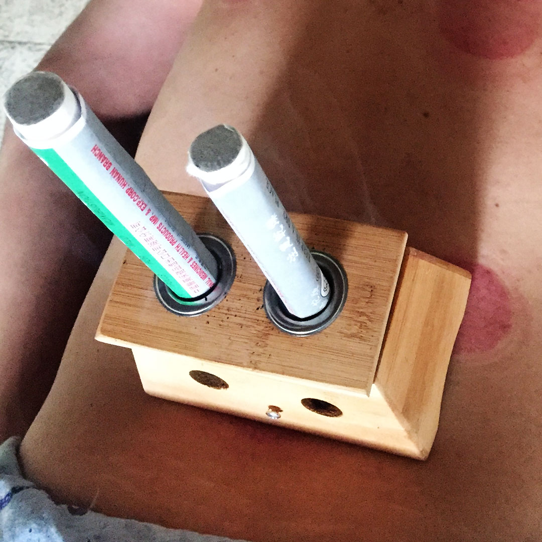 moxa1